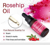 Pure Rosehip Oil Organic Cbd